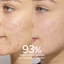 Afbeelding in Gallery-weergave laden, Caudalie Vinopure Fluide Anti Imperfections 40ml - Caudalie - Huidproducten.nl
