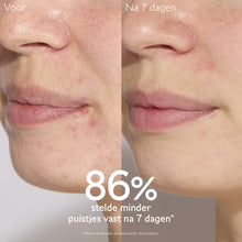 Afbeelding in Gallery-weergave laden, Caudalie Vinopure Serum Salicylique Anti-imperfections 30ml - Caudalie - Huidproducten.nl
