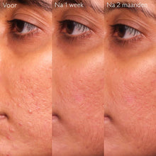 Afbeelding in Gallery-weergave laden, Caudalie Vinopure Serum Salicylique Anti-imperfections 30ml - Caudalie - Huidproducten.nl
